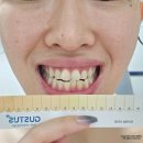 자신있게 | 구스투스 셀프 치아미백으로 웃을 때 자신있게!(사용법, 찐 후기)