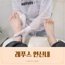 은평구 내성발톱 발각질 레푸스 연신내점 굳은살 제거 후기
