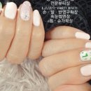 강자안손톱 이미지