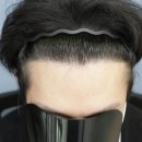 압구정모비앙의원 이미지