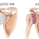 현메디 네이버블로그