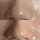 상동프라자 | 상동 피부관리 잘하는 곳 뷰티포톤피아 블랙헤드&amp;여드름&amp;모공 관리 후기