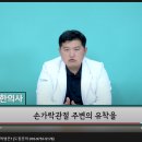 손가락 관절염, 류마티스 관절염은 유착때문에 이미지