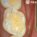이한치과기공소 이미지