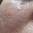 라쿠나 | [공지] 드레스보다 더 빛나는 피부, 예비 신부 프로그램 라쿠나 블룸(Bloom)