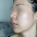 능곡예인의원 이미지