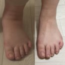 청주미즈맘산후조리원 | [청주미즈맘산후조리원] 맘풀 산후케어 얼마나 빠질까