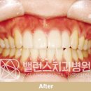 아침치과기공소 이미지