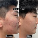 주식회사 더크리에이션 | 비아블 셀비아 앰플 값싼 가격에 속지마세요! 현명하게 구매하는 방법 [ 쿠팡,네이버쇼핑 가격 비교]