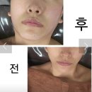 오늘은밝은피부 이미지