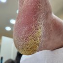 레푸스화곡점 | 레푸스 화곡점 발톱무좀 케어 후기 - 음식점 주방 근무자가 선택한 이유