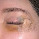 새손병원 | 안면봉합 후기 . 대전 새손병원 , 대전 안면봉합 잘 하는 병원