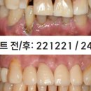 평택아름다운치과의원 네이버블로그
