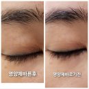 아이뻐뷰티 | 이젠 연장끊은 에스더의 인생 속눈썹 영양제 아이뻐 12차 공구 5주년 기념 듀얼영양제 투명 + 블랙 두...