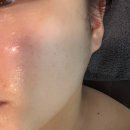 수연 | 부산 하단피부관리추천 " 수연에스테틱 " 후기