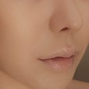 청담리즈의원 네이버블로그