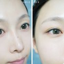 피스티오 이미지