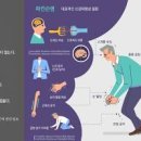 도파민 부족 결핍 증상 근육이상 세가와병 원인 이미지
