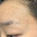 오투성형외과 | 천호 피부관리실 유나에스테틱에서 미네랄오투스파받고 피부진정 힐링