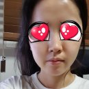 장갑성애플치과의원 | [사랑니 발치] 문정동 이처럼 치과 리뷰, 통증, 붓기 기록, 매복사랑니