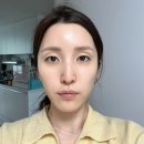 강남피부과 브이맥스 리프팅 레이저 후기 가격