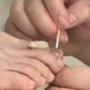 오창동물병원 | 청주 오창 내성발톱 관리 맛집 ‘아름다운 손길’ 통증 줄어든 발톱 관리