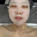 예쁨주의보 | 김해 내외동 에스테틱 예쁨주의보 스피큘 관리 후기