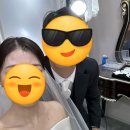 달채 | 결혼식 한달전 염증주사 맞고 패인채로 결혼하게된 후기 및 회복과정 대장정 1편 (염증주사 부작용으로...