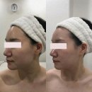 힐링과 피부 케어를 동시에 홍대 예본에서 경험한 특별한 관리