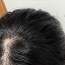오늘,하루헤어샵 | 보타미안엔젤 LPP 트리트먼트ㅣ청담동 헤어샵 트리트먼트 후기