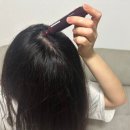 곽 헤어뷰티 | 정수리탈모엔 쿤달앰플 두피 탄력과 볼륨 살아나는 느낌
