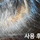 엠포로스 이미지