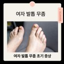 쏘앤네일