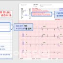 석메디칼 이미지