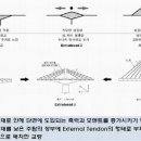 출퇴근 대란 감수하고 내부순환로(정릉천고가)를 전격 폐쇄한 이유는? 이미지