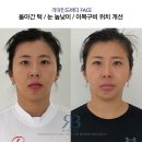 리마인드바디 이미지