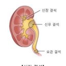 오른쪽 옆구리 통증 원인 대비 이미지