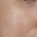 온뷰티with페디크루 - 76230 | 병점피부 온뷰티with페디크루 플라즈마 기미제거