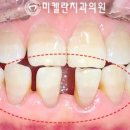 강남미켈란의원 이미지