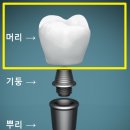 뿌리치과기공소 이미지