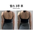 첨단기업로2L(2)-23 | 팔뚝 무한람스 후 3차 후관리까지 모두 마친 시점 후기(통증, 흉터, 운동, 팔뚝살 다이어트)