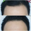 김헤어라인 이미지