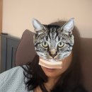 소리숨이비인후과의원 | 서울 선릉역 연세고른숨이비인후과 비중격만곡증(비중격교정술) 및 하비갑개점막하 절제술 비염 수술 후기