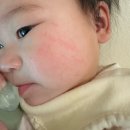 6개월아기 어라운드위고 명절복주머니 사용후기 / 7개월아기 기침가래콧물 아픔