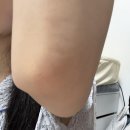 바디조짐 | 흑꿈치 해결해주는 바디미백크림 후기