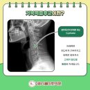 더하기빼기한의원 네이버블로그