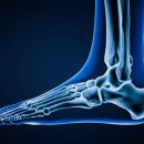 인라인 스케이팅 이미지