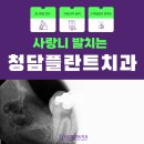 사랑니 발치 후기_ 청담플란트치과의원💜