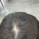 녹양 헤어샵 | 녹양동 미용실 '제이헤어' 두피클리닉 추천