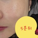 치유센터 화장실 | 진짜 솔직한 효소자연치유센터 방문후기 ㅣ성남효소찜질 ㅣ사장님 eye close...